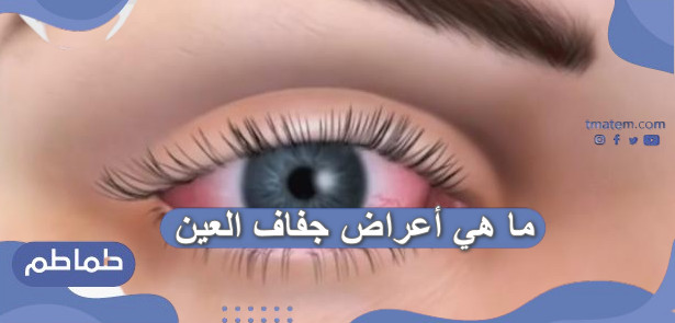 ما هي أعراض جفاف العين